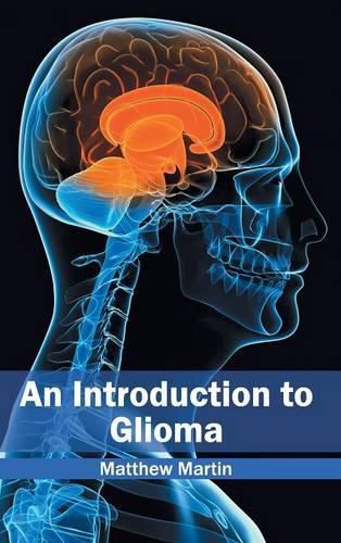 Cover image for Introduction to Glioma