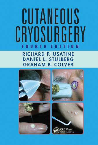 Cover image for Cutaneous Cryosurgery