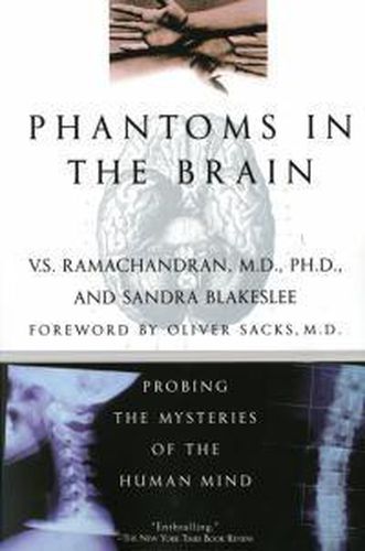 Cover image for Phantoms in the Brain