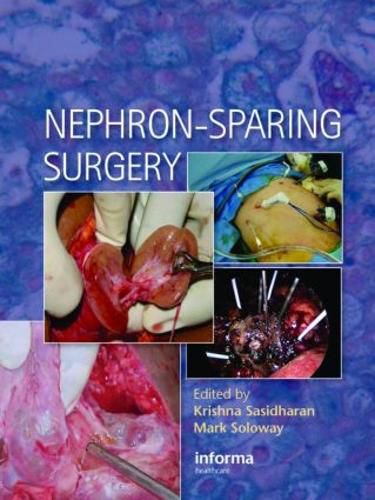 Cover image for Nephron-Sparing Surgery