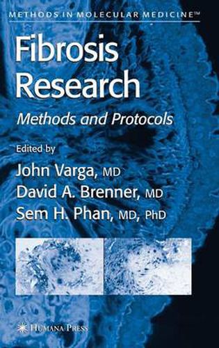 Cover image for Fibrosis Research: Methods and Protocols