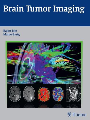 Cover image for Brain Tumor Imaging