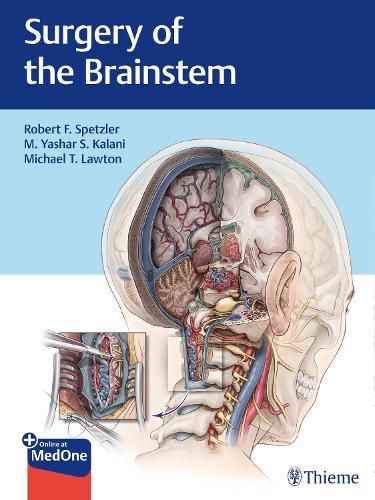 Cover image for Surgery of the Brainstem