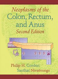 Cover image for Neoplasms of the Colon, Rectum, and Anus