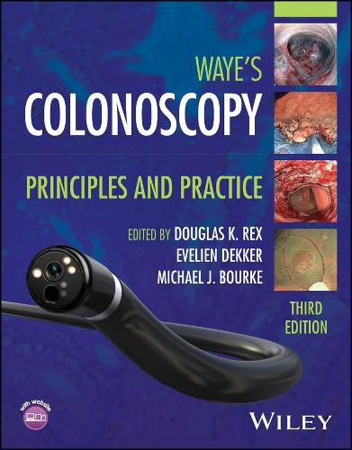 Cover image for Colonoscopy