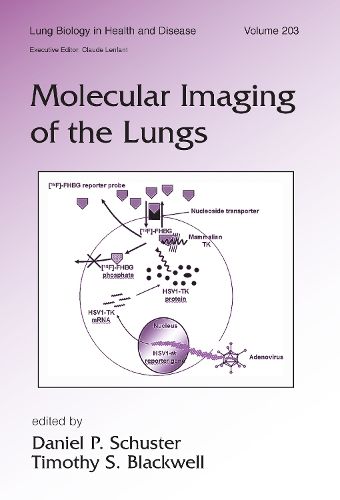 Cover image for Molecular Imaging of the Lungs