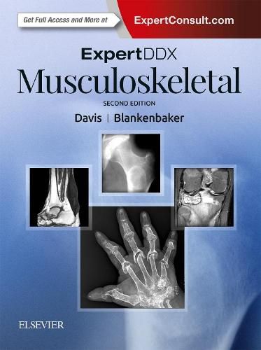 Cover image for ExpertDDx: Musculoskeletal