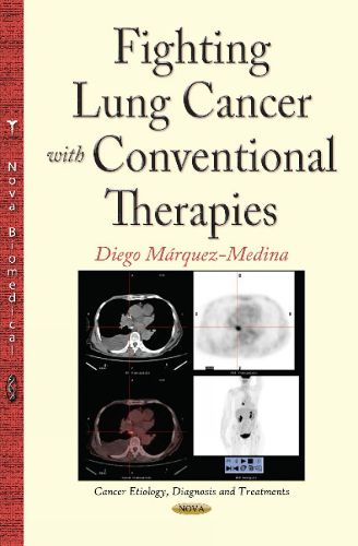 Cover image for Fighting Lung Cancer with Conventional Therapies