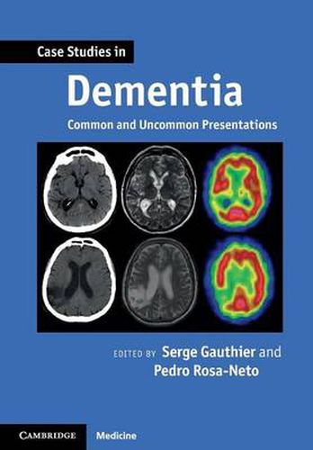 Cover image for Case Studies in Dementia: Volume 1: Common and Uncommon Presentations
