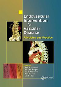 Cover image for Endovascular Intervention for Vascular Disease: Principles and Practice
