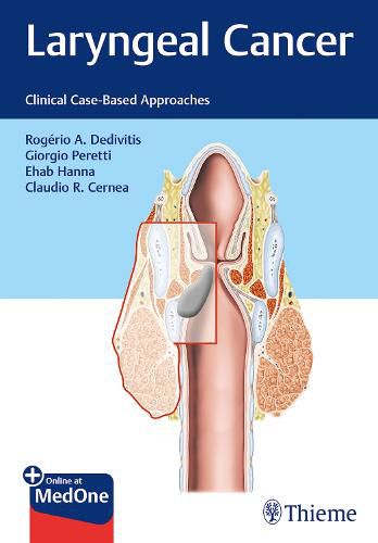 Cover image for Laryngeal Cancer: Clinical Case-Based Approaches