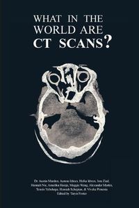 Cover image for What in the World are CT Scans?