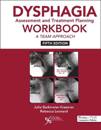 Dysphagia Assessment and Treatment Planning Workbook 2025