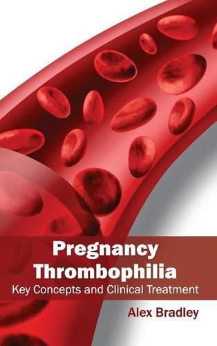 Cover image for Pregnancy Thrombophilia: Key Concepts and Clinical Treatment