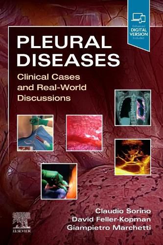 Cover image for Pleural Diseases: Clinical Cases and Real-World Discussions