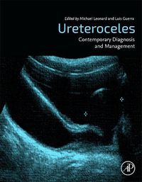 Cover image for Ureteroceles