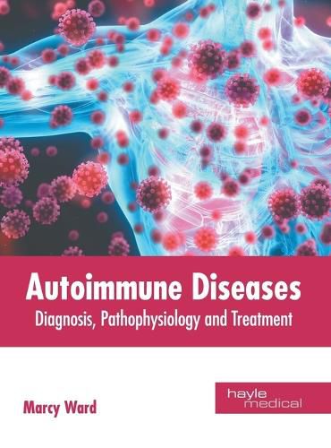 Cover image for Autoimmune Diseases: Diagnosis, Pathophysiology and Treatment