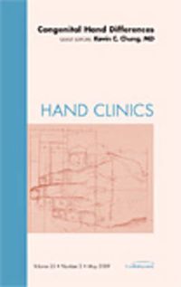 Cover image for Congenital Hand Differences, An Issue of Hand Clinics