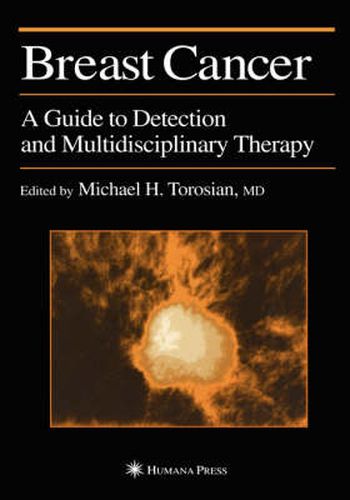 Cover image for Breast Cancer: A Guide to Detection and Multidisciplinary Therapy