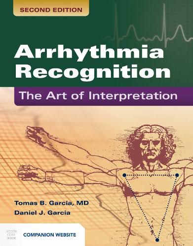 Cover image for Arrhythmia Recognition: The Art Of Interpretation