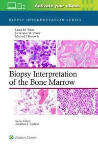 Cover image for Biopsy Interpretation of the Bone Marrow: Print + eBook with Multimedia