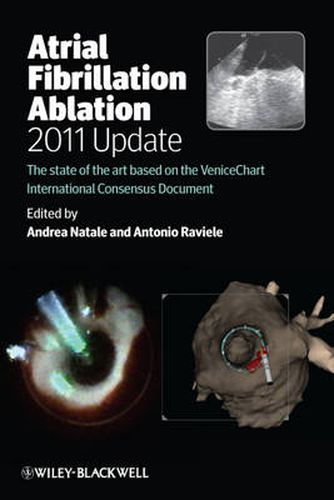 Cover image for Atrial Fibrillation Ablation, 2011 Update: The State of the Art Based on the Venice Chart International Consensus Document