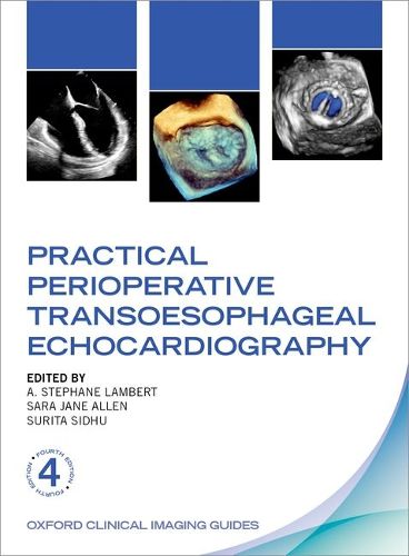 Cover image for Practical Perioperative Transoesophageal Echocardiography
