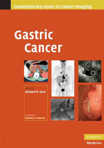 Cover image for Gastric Cancer