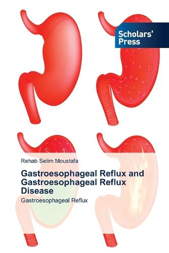 Cover image for Gastroesophageal Reflux and Gastroesophageal Reflux Disease