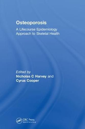 Cover image for Osteoporosis: A Lifecourse Epidemiology Approach to Skeletal Health