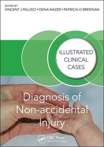 Cover image for Diagnosis of Non-accidental Injury: Illustrated Clinical Cases