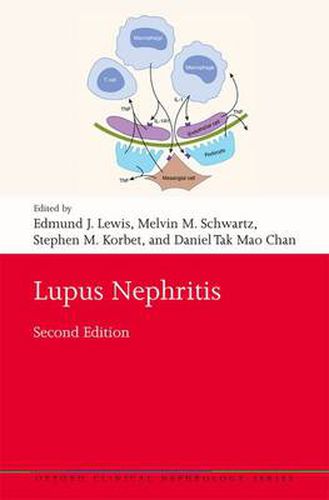 Cover image for Lupus Nephritis