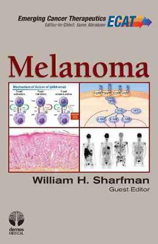 Cover image for Melanoma