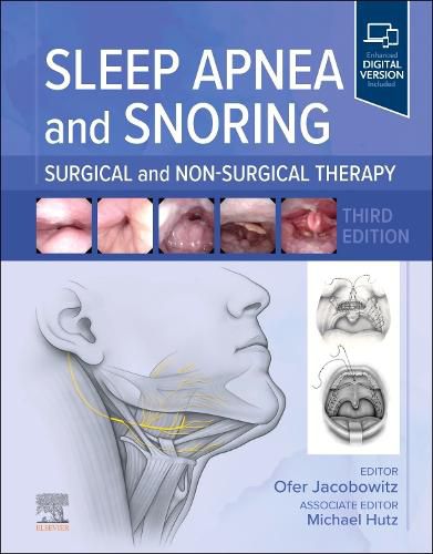 Cover image for Sleep Apnea and Snoring