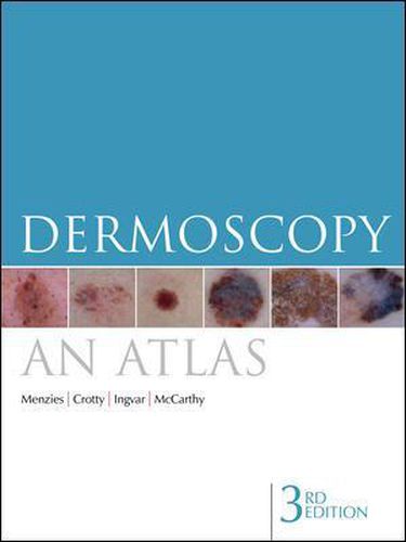 Cover image for Dermoscopy