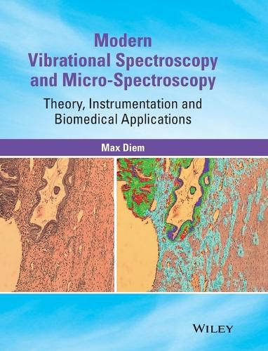 Cover image for Modern Vibrational Spectroscopy and Micro-Spectroscopy: Theory, Instrumentation and Biomedical Applications