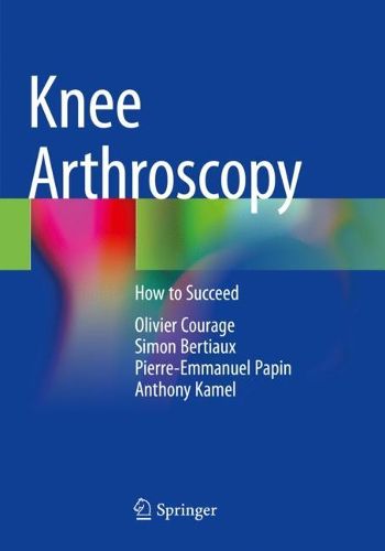 Cover image for Knee Arthroscopy: How to Succeed