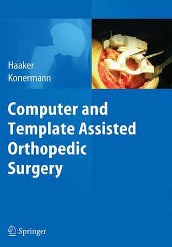 Computer and Template Assisted Orthopedic Surgery