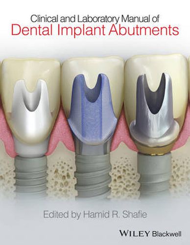 Cover image for Clinical and Laboratory Manual of Dental Implant Abutments