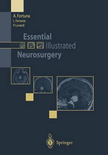 Cover image for Essential Illustrated Neurosurgery