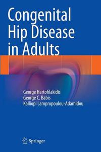 Cover image for Congenital Hip Disease in Adults