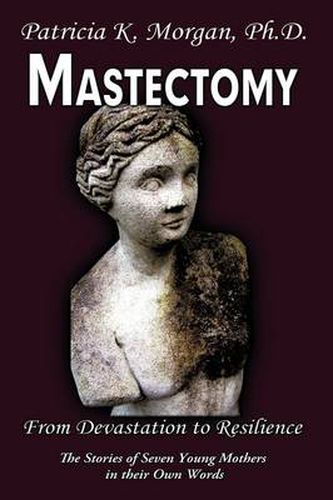 Cover image for Mastectomy