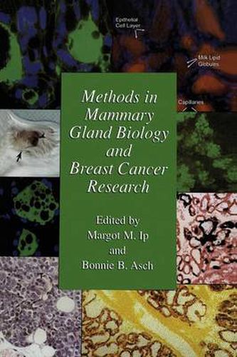 Cover image for Methods in Mammary Gland Biology and Breast Cancer Research