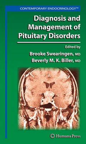 Cover image for Diagnosis and Management of Pituitary Disorders