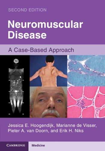 Cover image for Neuromuscular Disease