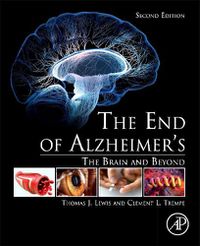 Cover image for The End of Alzheimer's: The Brain and Beyond