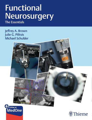 Cover image for Functional Neurosurgery: The Essentials