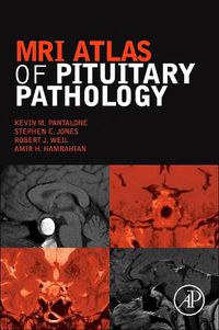 Cover image for MRI Atlas of Pituitary Pathology