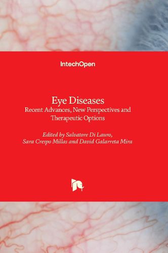 Cover image for Eye Diseases