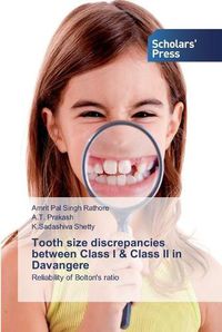 Cover image for Tooth size discrepancies between Class I & Class II in Davangere